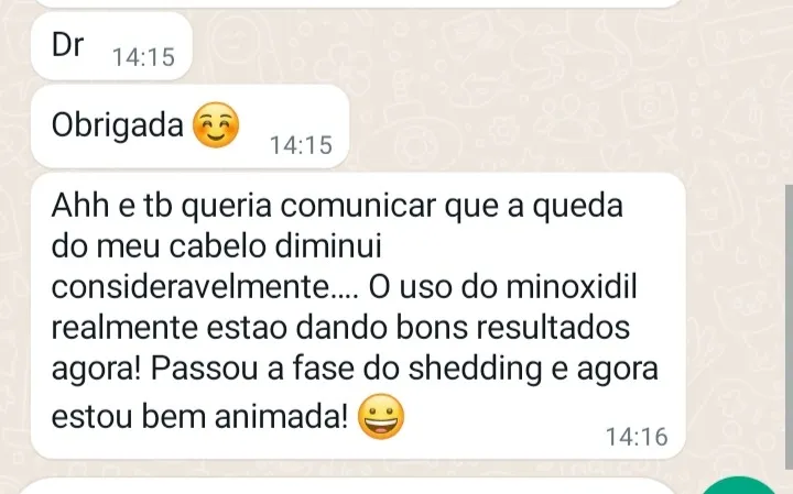 Depoimento Shedding minoxidil