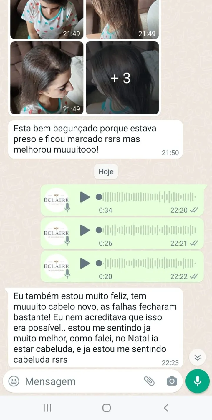 depoimento alopecia importante