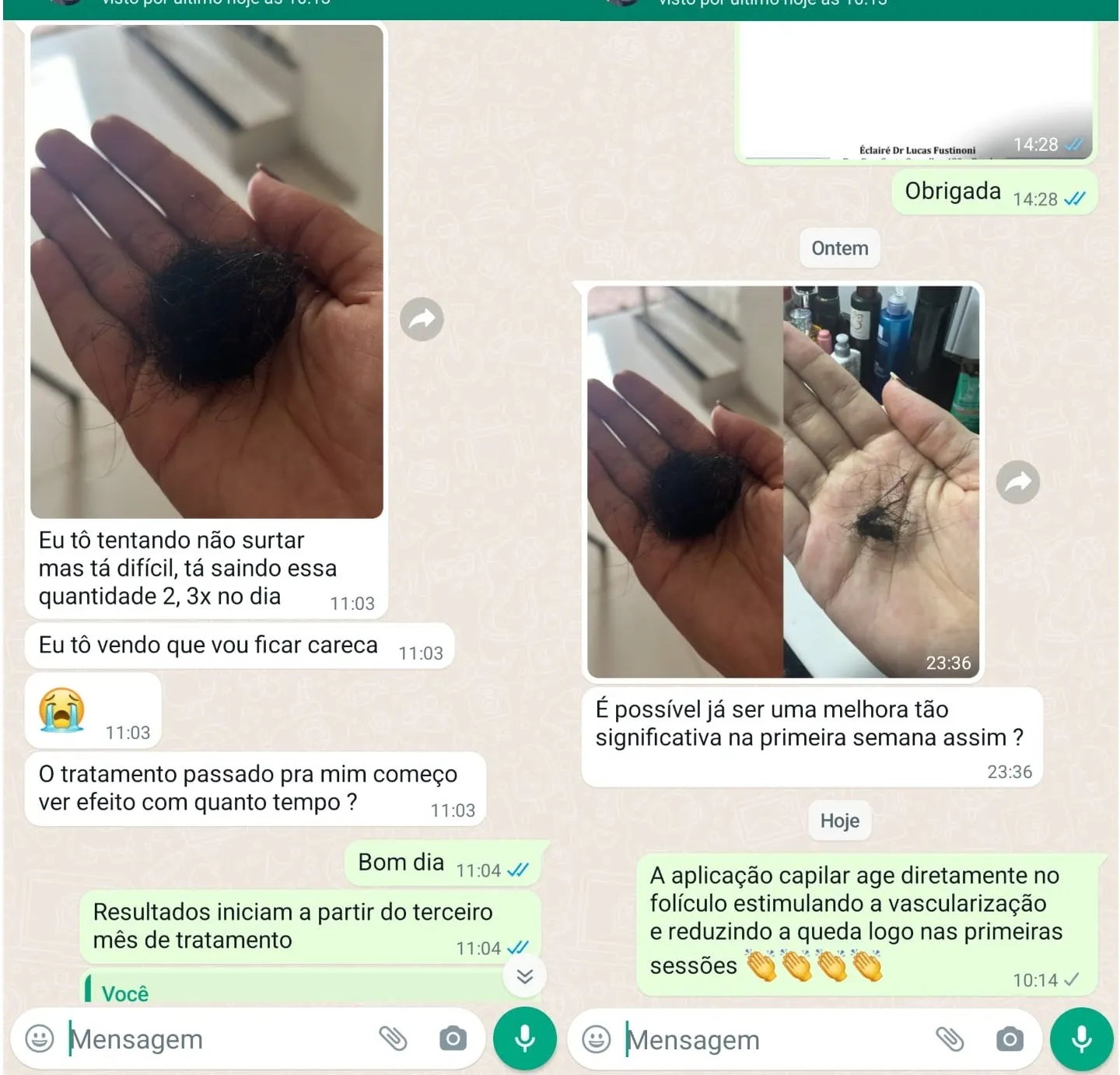 depoimento queda importante