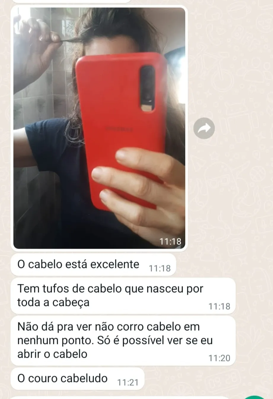 depoimento tufos cabelo