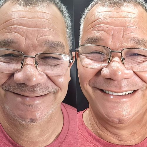 José Ribeiro antes e depois