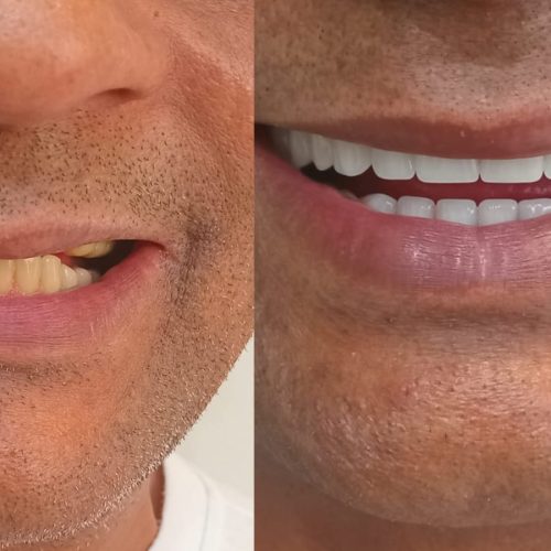 PROTOCOLO- ANISIO SANTANA ID 1719