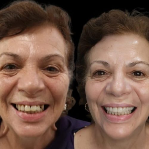 PROTOCOLO - ELISETE FOZ. ID 2051