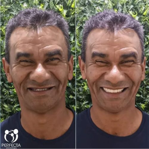 PROTOCOLO GIDINALDO VICENTE ID324