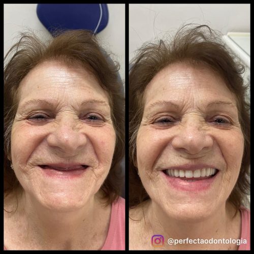 PROTOCOLO HELENA FOZ ID1194