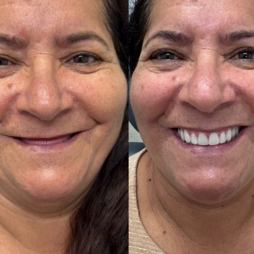 PROTOCOLO -LUZIA GALVANI ID 2306