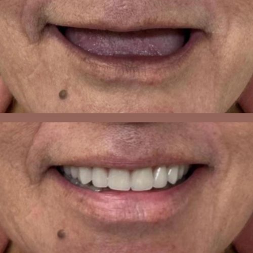 PROTOCOLO- TELMA FERERIRA ID-2147